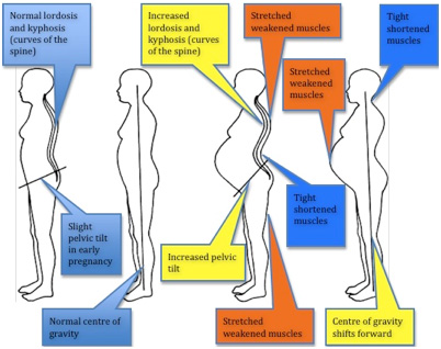 pain in curve of spine